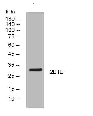Anti-HLA-DRB1 antibody (194-244 aa) (STJ194331) – Figure 1 of 1