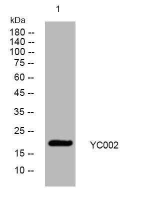 Anti-YC002 antibody (66-116 aa) (STJ194356) – Figure 1 of 1