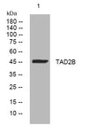 Anti-TADA2B antibody (220-270 aa) (STJ194361) – Figure 1 of 1