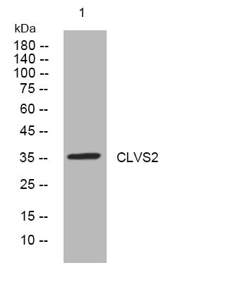 Anti-CLVS2 antibody (26-76 aa) (STJ194403) – Figure 1 of 1