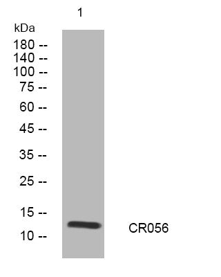 Anti-TYMSOS antibody (27-77 aa) (STJ194410) – Figure 1 of 1