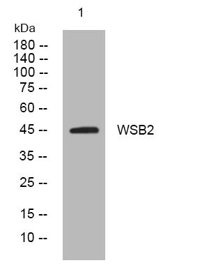 Anti-WSB2 antibody (248-298 aa) (STJ194427) – Figure 1 of 1