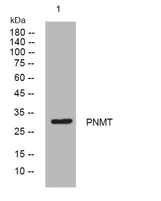 Anti-PNMT antibody (96-146 aa) (STJ194434) – Figure 1 of 1