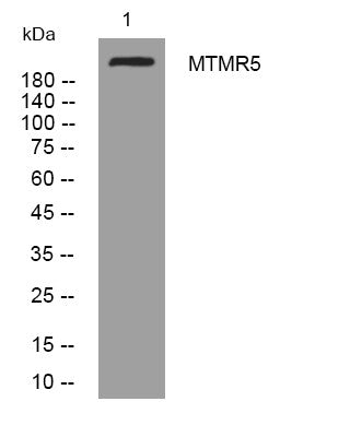 Anti-SBF1 antibody (320-370 aa) (STJ194487) – Figure 1 of 1