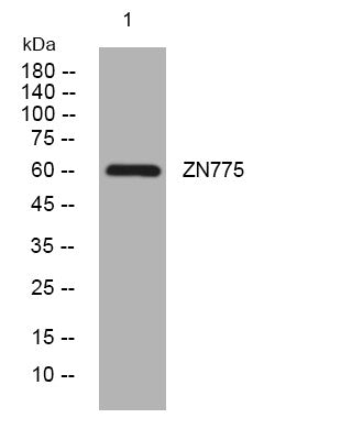 Anti-ZNF775 antibody (66-116 aa) (STJ194496) – Figure 1 of 1
