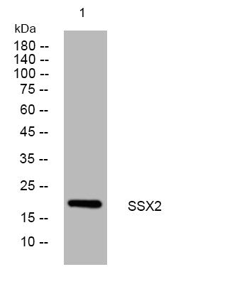 Anti-SSX2/SSX2B antibody (16-66 aa) (STJ194503) – Figure 1 of 1