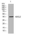 Anti-AADACL2 antibody (74-124 aa) (STJ194508) – Figure 1 of 1