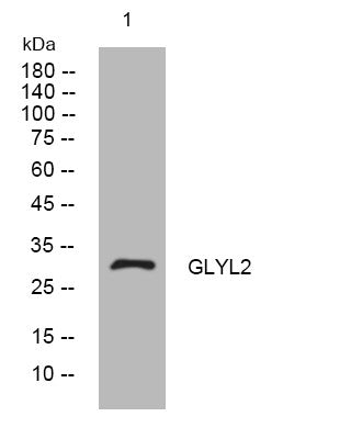 Anti-GLYATL2 antibody (84-134 aa) (STJ194514) – Figure 1 of 1