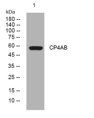 Anti-CYP4A11 antibody (389-439 aa) (STJ194517) – Figure 1 of 1