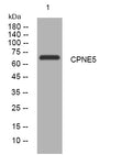 Anti-CPNE5 antibody (191-241 aa) (STJ194536) – Figure 1 of 1