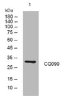Anti-C17orf99 antibody (90-140 aa) (STJ194541) – Figure 1 of 1