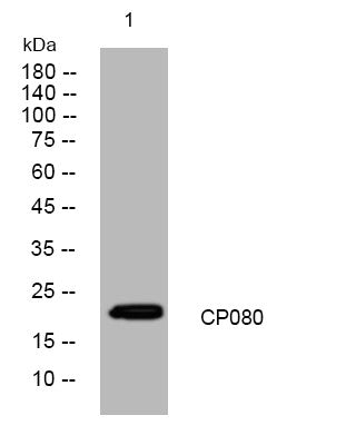 Anti-CFAP20 antibody (33-83 aa) (STJ194569) – Figure 1 of 1