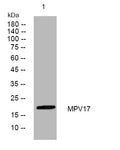 Anti-MPV17 antibody (45-95 aa) (STJ194570) – Figure 1 of 1