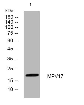 Anti-MPV17 antibody (45-95 aa) (STJ194570) – Figure 1 of 1