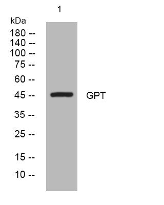Anti-DPAGT1 antibody (209-259 aa) (STJ194577) – Figure 1 of 1