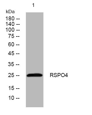 Anti-RSPO4 antibody (43-93 aa) (STJ194587) – Figure 1 of 1