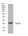 Anti-TLCD5 antibody (77-127 aa) (STJ194596) – Figure 1 of 1
