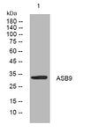 Anti-ASB9 antibody (169-219 aa) (STJ194602) – Figure 1 of 1