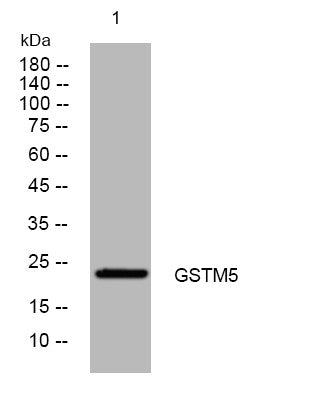 Anti-GSTM5 antibody (99-149 aa) (STJ194617) – Figure 1 of 1