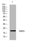 Anti-PRH1.PRH2 antibody (81-131 aa) (STJ194628) – Figure 1 of 1