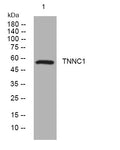Anti-CFAP53 antibody (59-109 aa) (STJ194635) – Figure 1 of 1