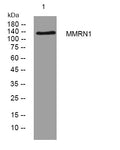 Anti-MMRN1 antibody (963-1013 aa) (STJ194637) – Figure 1 of 1