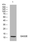 Anti-GAGE2E antibody (62-112 aa) (STJ194652) – Figure 1 of 1