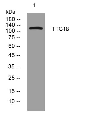 Anti-CFAP70 antibody (963-1013 aa) (STJ194661) – Figure 1 of 1