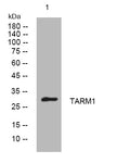 Anti-TARM1 antibody (36-86 aa) (STJ194662) – Figure 1 of 1