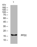 Anti-PFDN2 antibody (81-131 aa) (STJ194667) – Figure 1 of 1