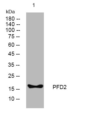 Anti-PFDN2 antibody (81-131 aa) (STJ194667) – Figure 1 of 1
