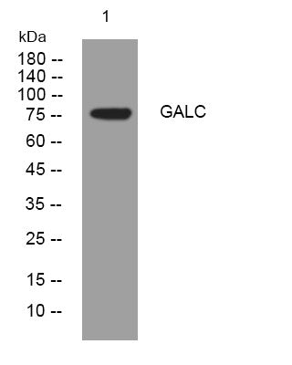 Anti-GALC antibody (481-531 aa) (STJ194672) – Figure 1 of 1