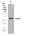 Anti-HACD3 antibody (255-305 aa) (STJ194675) – Figure 1 of 1