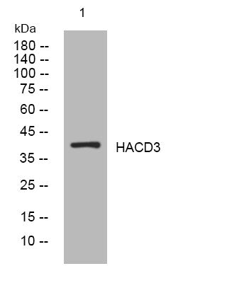 Anti-HACD3 antibody (255-305 aa) (STJ194675) – Figure 1 of 1