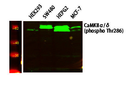 Anti-Phospho-CaMK2-Thr286 antibody (STJ194696) – Figure 1 of 1