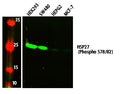 Anti-Phospho-HSPB1-S78/82 antibody (STJ194697) – Figure 1 of 1