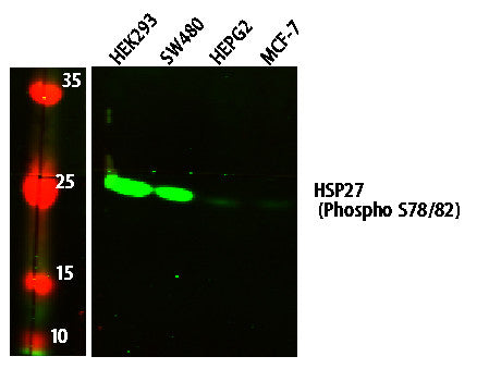 Anti-Phospho-HSPB1-S78/82 antibody (STJ194697) – Figure 1 of 1