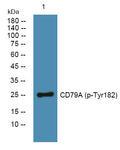 Anti-Phospho-CD79A-Tyr182 antibody (STJ194704) – Figure 1 of 1