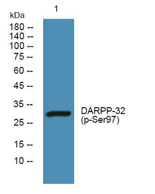 Anti-Phospho-PPP1R1B-Ser97 antibody (STJ194708) – Figure 1 of 1