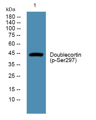 Anti-Phospho-DCX-Ser297 antibody (STJ194709) – Figure 1 of 1