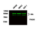 Anti-PDCD6IP antibody (410-490 aa) (STJ194755) – Figure 1 of 1