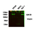 Anti-GOLGA2 antibody (STJ194763) – Figure 1 of 1