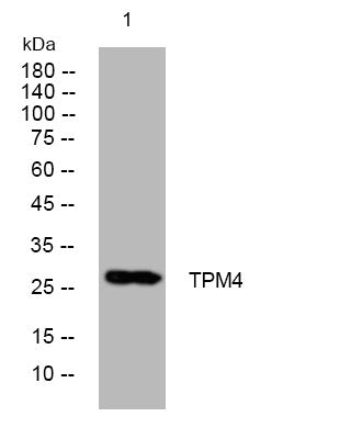 Anti-TPM4 antibody (127-177 aa) (STJ194771) – Figure 1 of 1