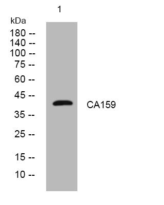 Anti-C1orf159 antibody (245-295 aa) (STJ194794) – Figure 1 of 1