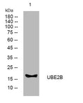 Anti-UBE2B antibody (23-73 aa) (STJ194797) – Figure 1 of 1