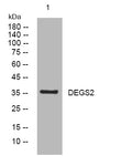 Anti-DEGS2 antibody (92-142 aa) (STJ194812) – Figure 1 of 1