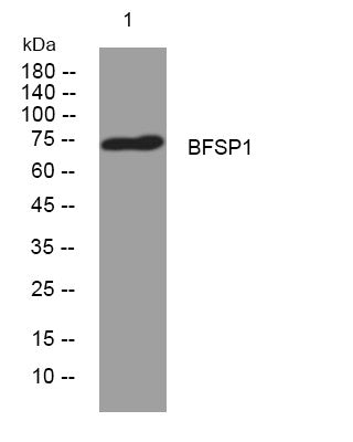 Anti-BFSP1 antibody (494-544 aa) (STJ194815) – Figure 1 of 1