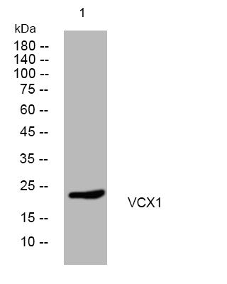Anti-VCX antibody (95-145 aa) (STJ194836) – Figure 1 of 1