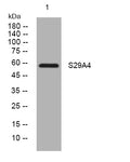 Anti-SLC29A4 antibody (404-454 aa) (STJ194839) – Figure 1 of 1