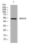 Anti-ZNF419 antibody (146-196 aa) (STJ194854) – Figure 1 of 1